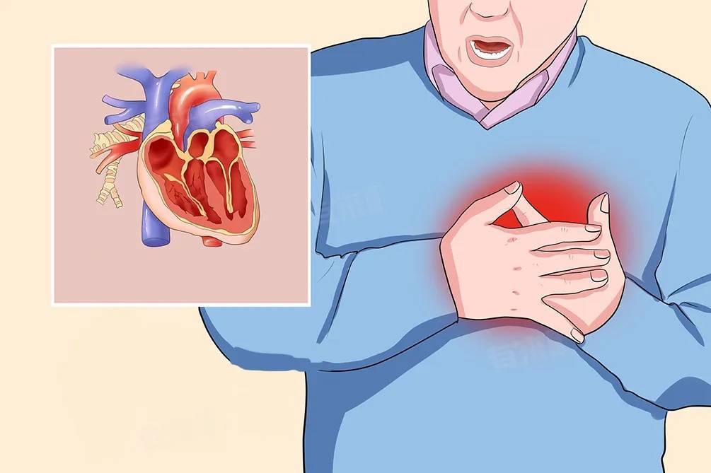 足球平台代理怎么做_一次亲热足球平台代理怎么做！杭州男子差点没命！这种凶险急症梅雨天高发