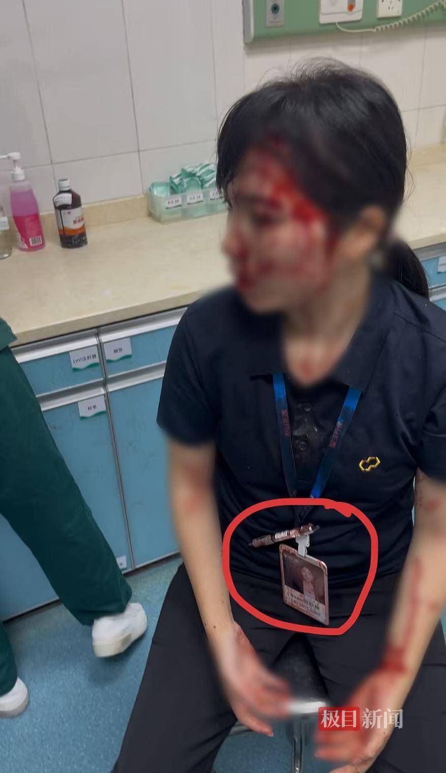 艾斯基斯迈vs洛森格德_“男子持水杯砸伤女同事被刑拘”后续：脸部缝20多针的女子已出院艾斯基斯迈vs洛森格德，否认抢单惹祸